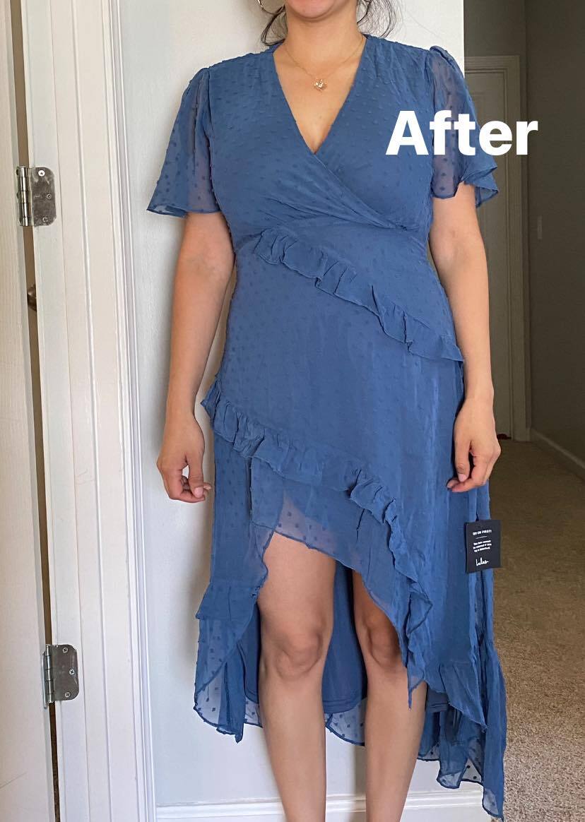 Before and After